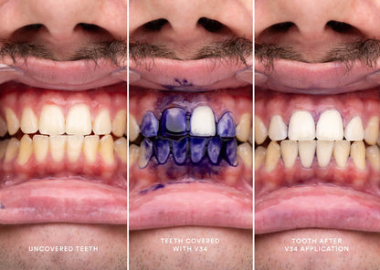 F&J Bright Smile 💥 ¡DI ADIÓS A LO AMARILLO EN 5 DÍAS!💥