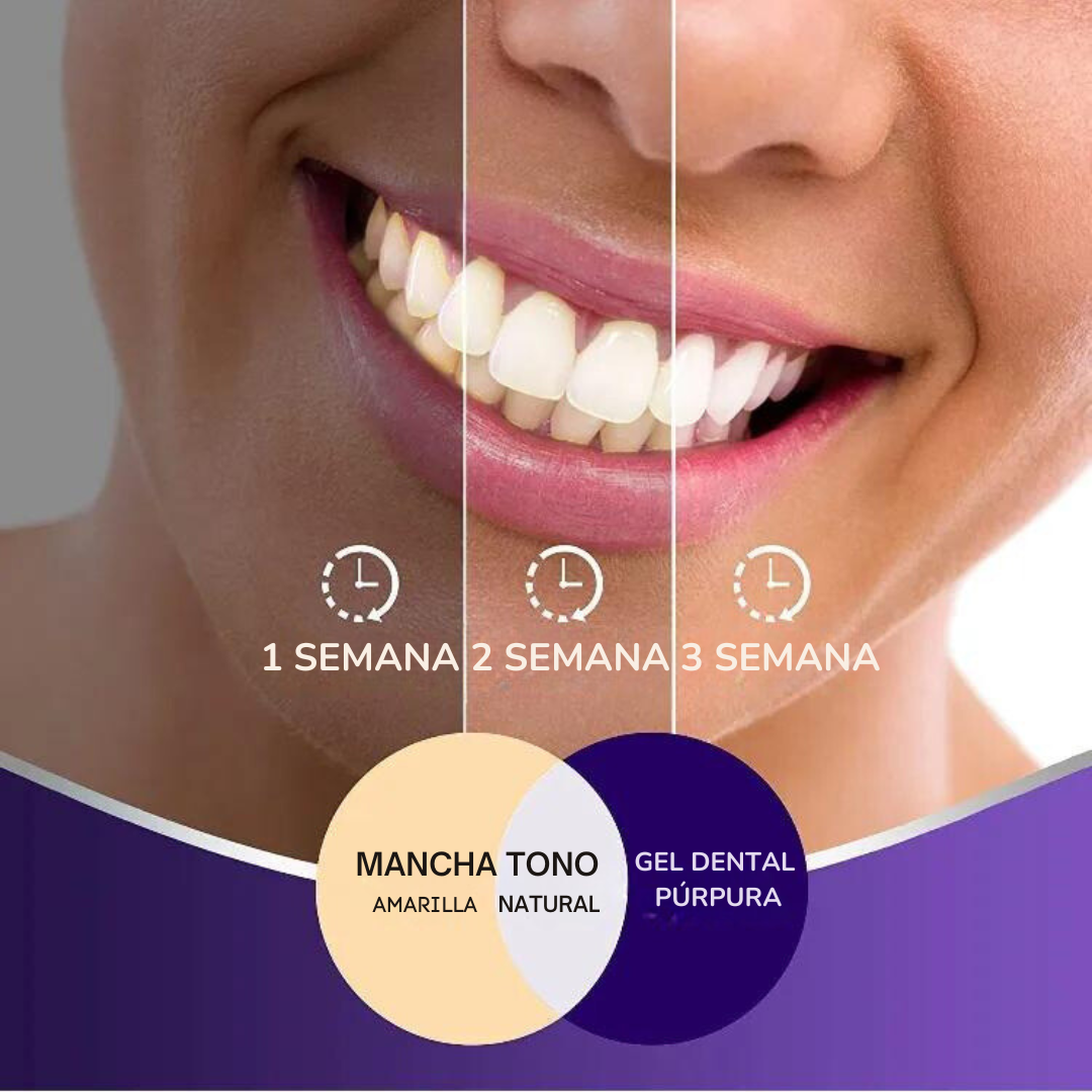 F&J Bright Smile 💥 ¡DI ADIÓS A LO AMARILLO EN 5 DÍAS!💥